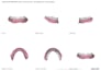 design exocad crowns, bridges and complete denture for you accurately